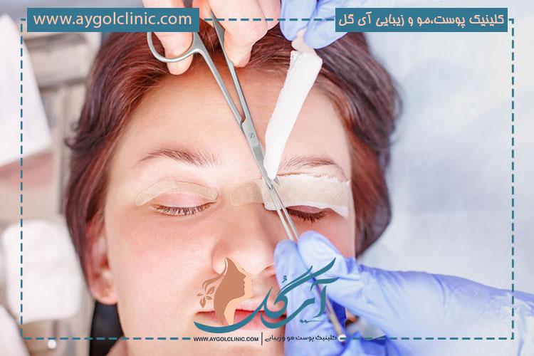 خدمات بلفاروپلاستی