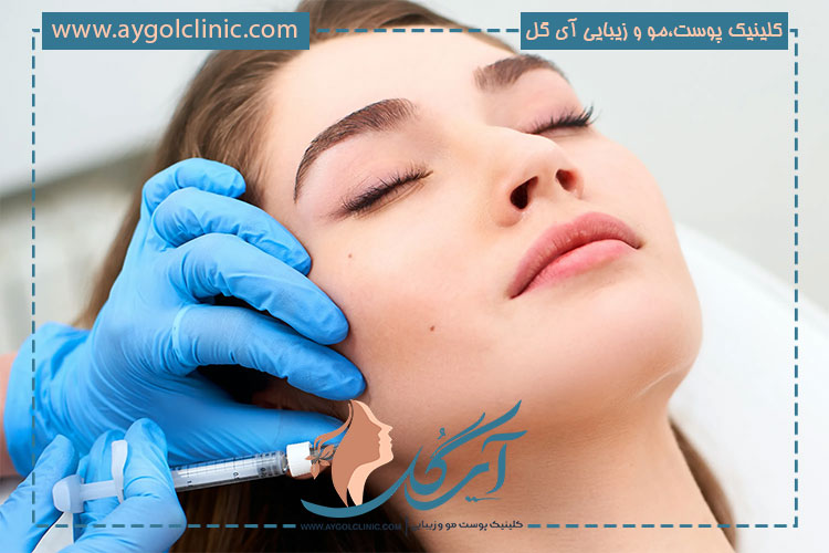 پر کننده های چانه و فک چه زمانی تاثیر خود را نشان میدهند؟