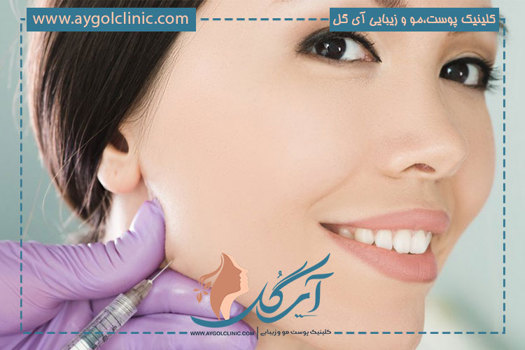  مراقبت های بعد از تزریق فیلر فک و چانه