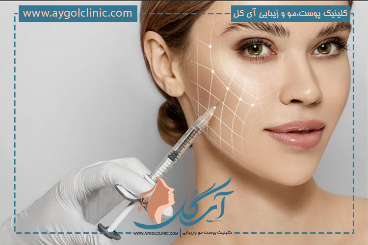 فیلر الانسه در چه مواردی مورد استفاده قرار می گیرد؟