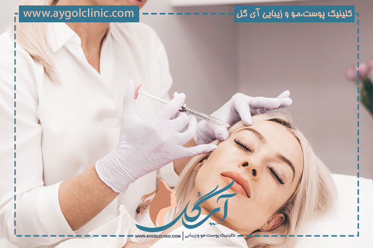 مزایای ماندگار تزریق فیلر شقیقه برای جوانسازی چهره