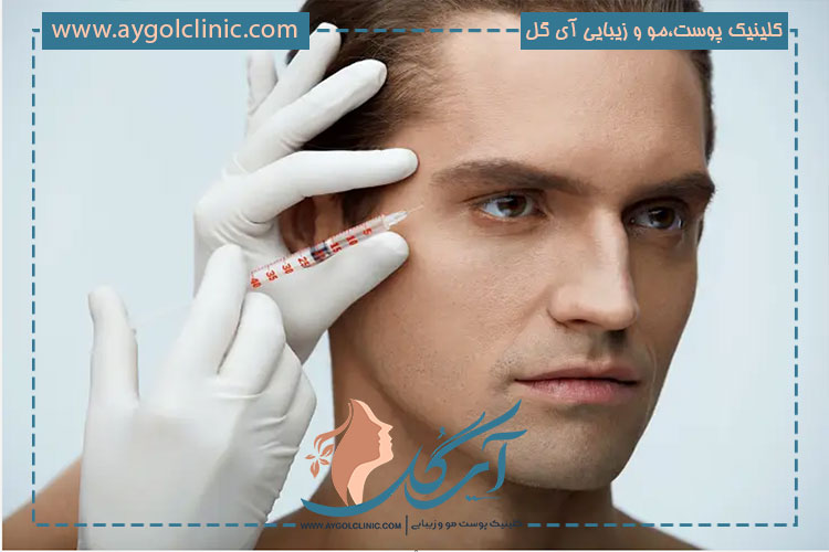 مزایای ماندگار تزریق فیلر شقیقه برای جوانسازی چهره