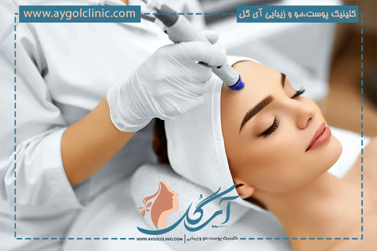مزوتراپی روی چه افرادی انجام میشود؟