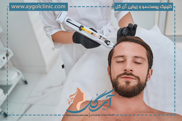 مزونیدلینگ پوست سر چگونه انجام میشود؟