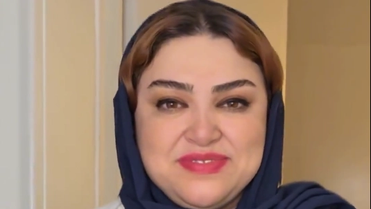 کاشت مو