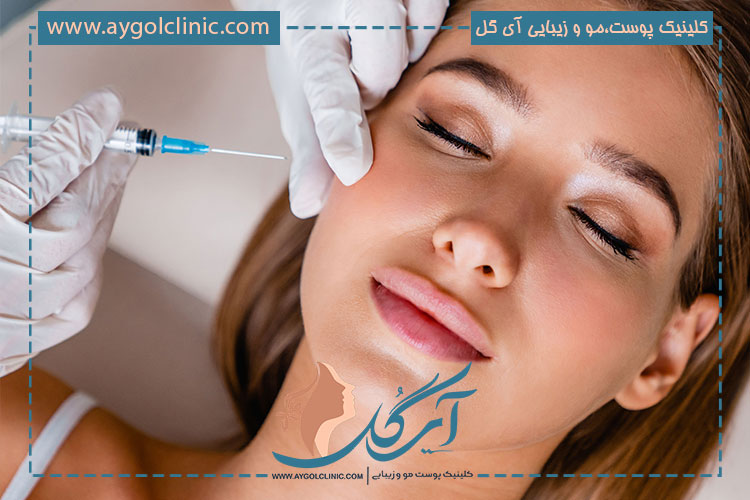تزریق-فیلر-جوانساز