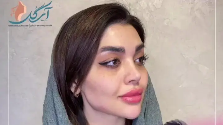 زاویه سازی فک و چانه