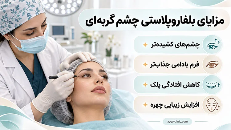 مزایای بلفاروپلاستی چشم گربه‌ای برای زیبایی بیشتر چشم‌ها