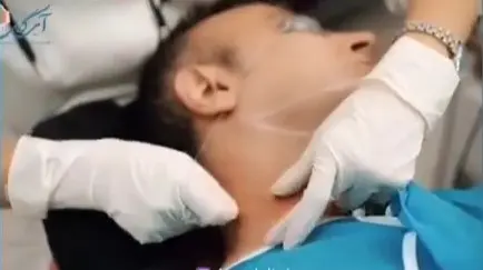 ویدیو اندولیفت