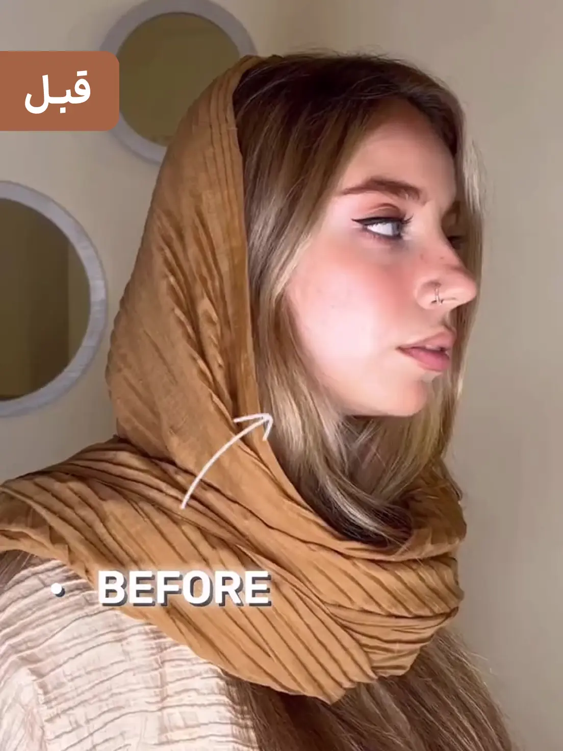 قبل زاویه سازی فک و چانه