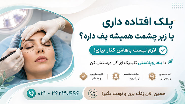 بلفاروپلاستی تخصصی پلک بالا و پایین در کلینیک آی گل