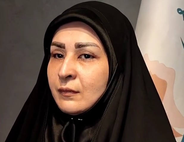 نمونه کار بلفاروپلاستی