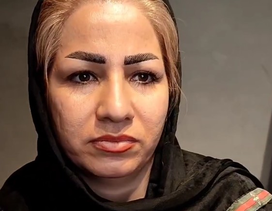 نمونه کار بلفاروپلاستی