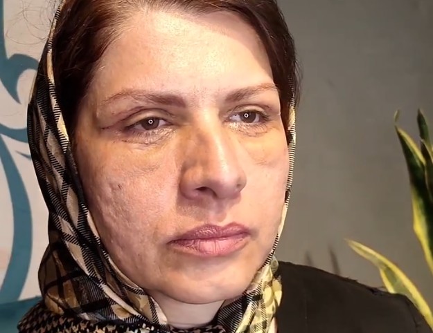 نمونه کار بلفاروپلاستی