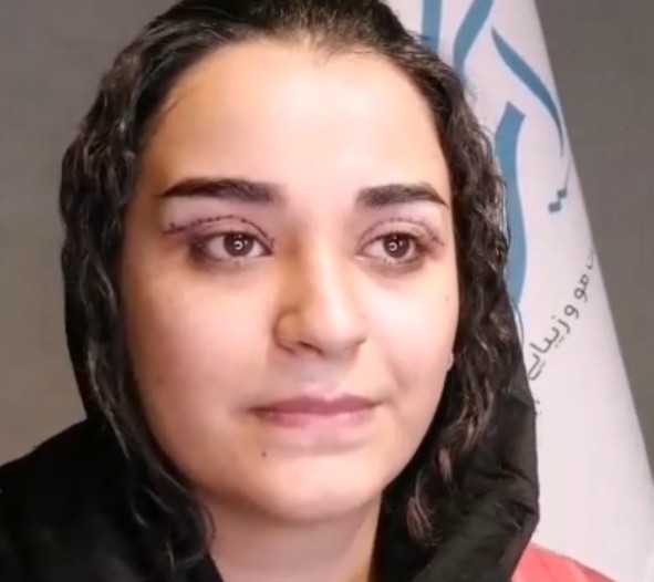 نمونه کار بلفاروپلاستی