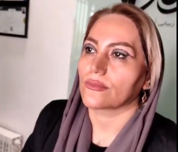نمونه کار بلفاروپلاستی