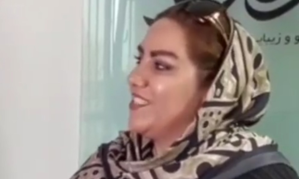 نمونه کار بلفاروپلاستی