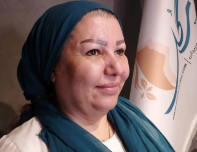 نمونه کار بلفاروپلاستی