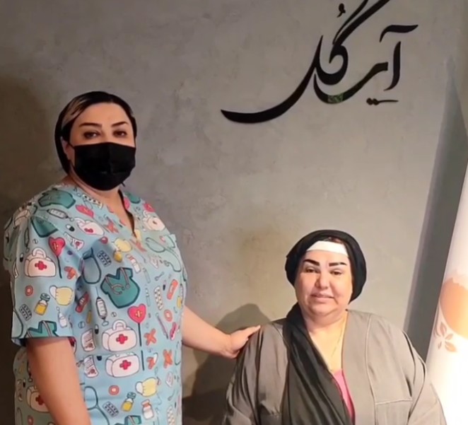 نمونه کار بلفاروپلاستی
