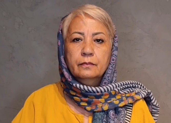 نمونه کار بلفاروپلاستی