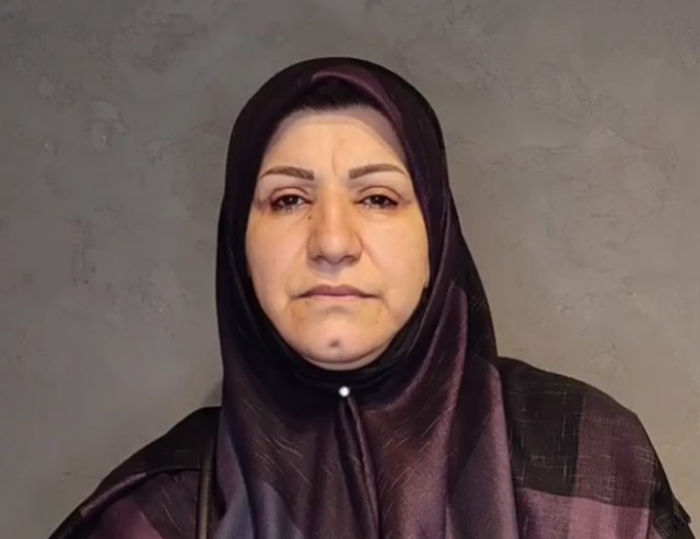 نمونه کار بلفاروپلاستی
