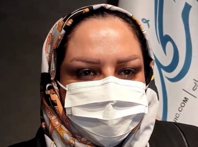 نمونه کار کاشت ابرو در کلینیک آی گل