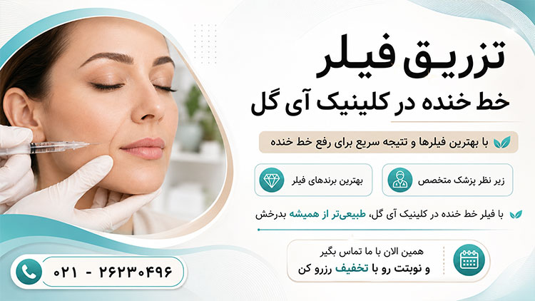 تزریق فیلر خط خنده برای رفع خطوط اطراف لب به صورت طبیعی