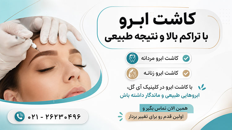 کاشت ابرو با بیشترین تراکم با قاب بسیار جذاب 