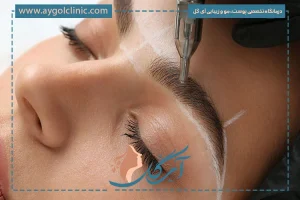 بهترین سن برای کاشت ابرو؛ بررسی سن مناسب از ۲۰ تا ۵۰ سالگی