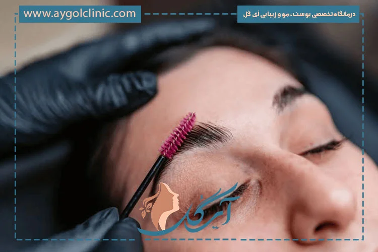 کاشت ابرو در 50سالگی با طراحی متناسب و تراکم طبیعی برای زیبایی چهره