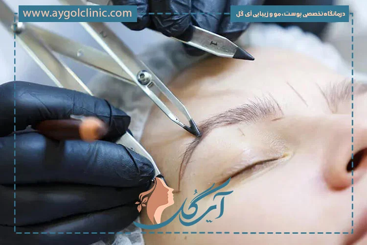 کاشت ابرو بهتره یا میکروبلدینگ؟ تفاوت میکروبلیدینگ با کاشت ابرو